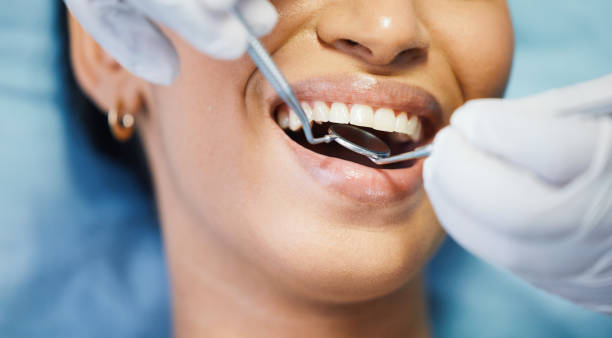 Best Emergency Dental Care for Broken or Chipped Teeth in Mount Hope, NJ